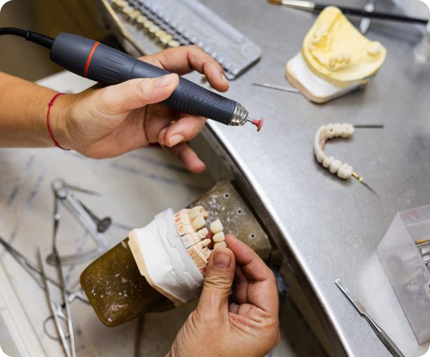Dental crowns are prepared in a dental laboratory.
