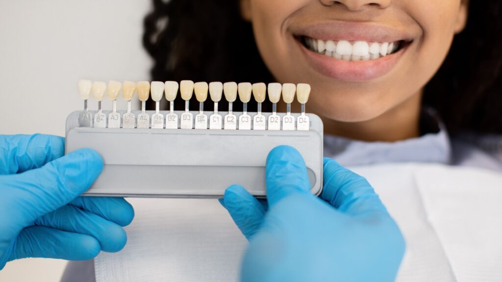 Dentist holds a tooth shade guide to help pick the best enamel color.