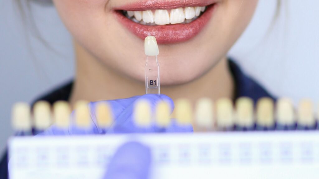 Dentistry taking the shade of a patient's tooth for a dental implant.